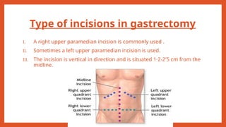 Abdominal surgeries physiotherapy management | PPTX