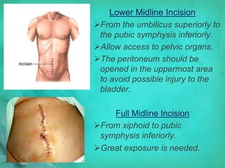 Abdominal surgery | PPTX