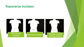 Transverse Incision:
Pfannestial
incision
Maryland incision Oblique muscle
cutting incision
 