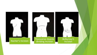 Kocher’s incision
Transverse muscle
dividing incision
McBurney’s
incision
 