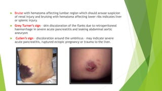  Bruise with hematoma affecting lumbar region which should arouse suspicion
of renal injury and bruising with hematoma affecting lower ribs indicates liver
or splenic injury.
 Grey Turner’s sign – skin discoloration of the flanks due to retroperitoneal
haemorrhage in severe acute pancreatitis and leaking abdominal aortic
aneurysm
 Cullen’s sign – discoloration around the umbilicus – may indicate severe
acute pancreatitis, ruptured ectopic pregnancy or trauma to the liver.
 