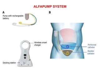 approach to ascites and abdominal swelling | PPTX