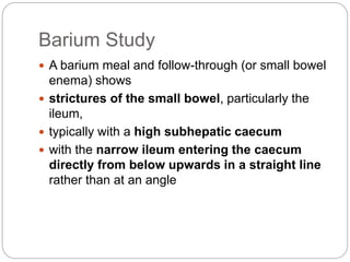 Barium Study
 A barium meal and follow-through (or small bowel
enema) shows
 strictures of the small bowel, particularly the
ileum,
 typically with a high subhepatic caecum
 with the narrow ileum entering the caecum
directly from below upwards in a straight line
rather than at an angle
 