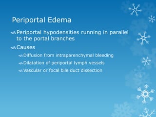 Periportal Edema
Periportal hypodensities running in parallel
to the portal branches
Causes
Diffusion from intraparenchymal bleeding
Dilatation of periportal lymph vessels
Vascular or focal bile duct dissection
 