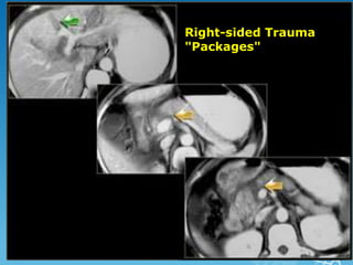 Right-sided Trauma
"Packages"
 