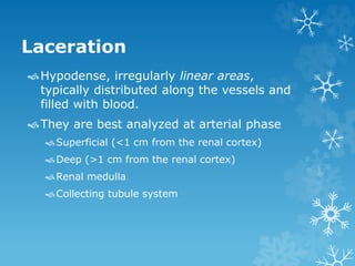 Laceration
Hypodense, irregularly linear areas,
typically distributed along the vessels and
filled with blood.
They are best analyzed at arterial phase
Superficial (<1 cm from the renal cortex)
Deep (>1 cm from the renal cortex)
Renal medulla
Collecting tubule system
 