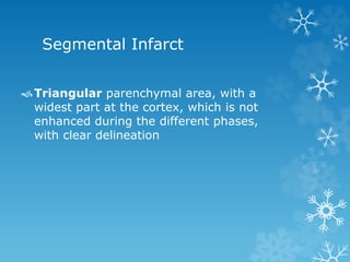 Segmental Infarct
Triangular parenchymal area, with a
widest part at the cortex, which is not
enhanced during the different phases,
with clear delineation
 