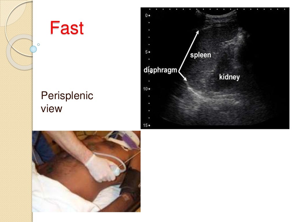 abdominal trauma abdominal trauma