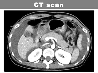 CT scan
 