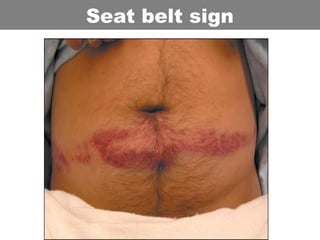 Seat belt sign
 