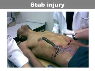 Stab injury
 