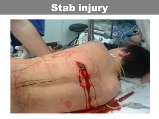 Stab injury
 