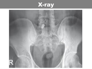 X-ray
 