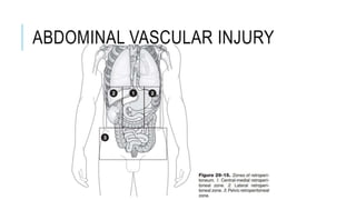 ABDOMINAL VASCULAR INJURY
 