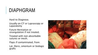 DIAPHGRAM
Hard to Diagnose.
Usually on CT or Laprascopy or
Laparatomy
Future Herniation or
strangulation if not treated.
Treated with non absorbable
sutures or mesh.
Flaps if contaminated, from:
Lat. Dorsi, omentum or biologic
grafts
 