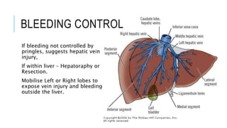 BLEEDING CONTROL
If bleeding not controlled by
pringles, suggests hepatic vein
injury,
If within liver – Hepatoraphy or
Resection.
Mobilise Left or Right lobes to
expose vein injury and bleeding
outside the liver.
 