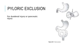 PYLORIC EXCLUSION
For duodenal injury or pancreatic
injury
 