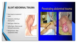 Abdominal trauma | PPTX