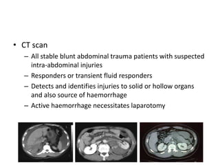 • CT scan
– All stable blunt abdominal trauma patients with suspected
intra-abdominal injuries
– Responders or transient fluid responders
– Detects and identifies injuries to solid or hollow organs
and also source of haemorrhage
– Active haemorrhage necessitates laparotomy
 