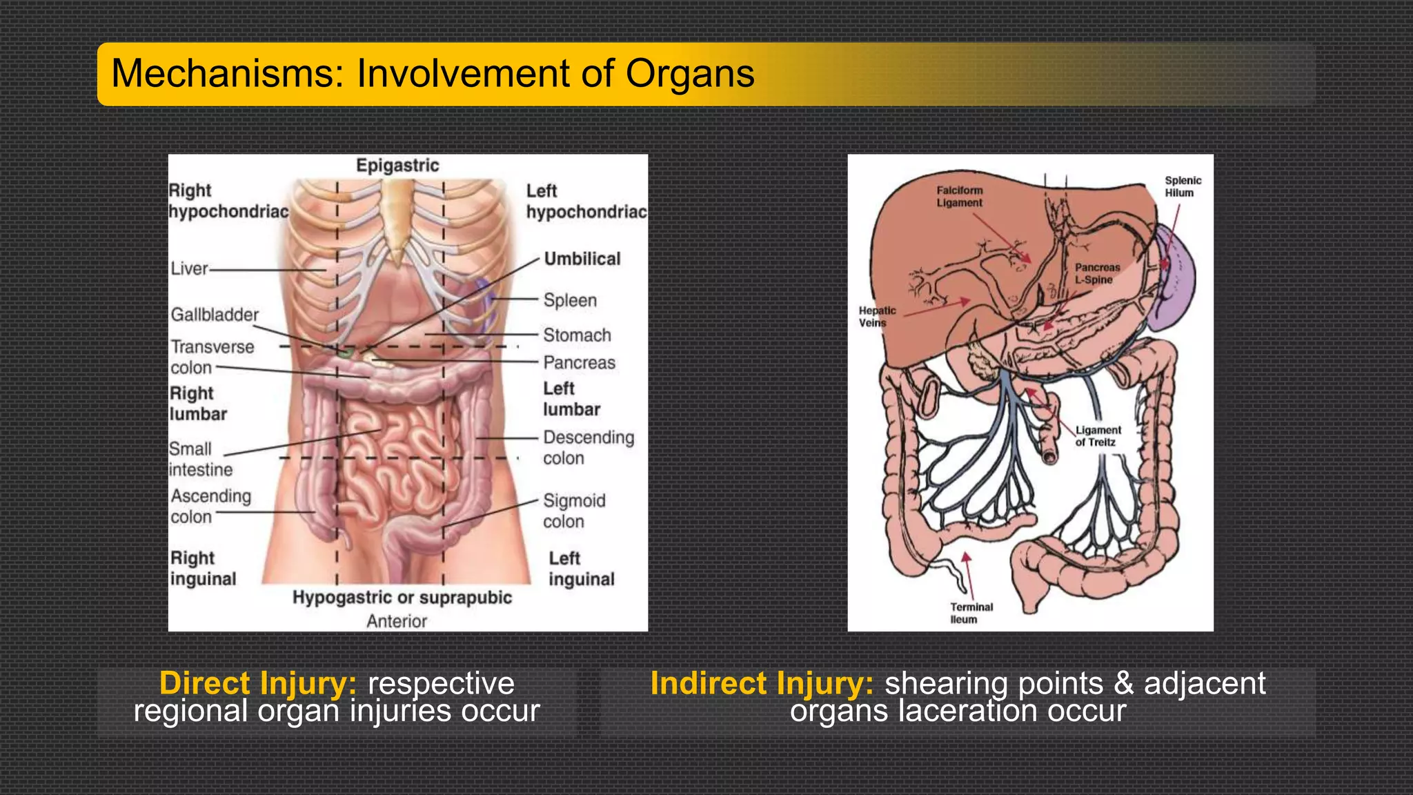Small Intestine Injury Abdominal trauma: diagnosis and management | PPTX