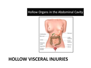 HOLLOW VISCERAL INJURIES
 