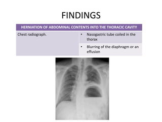 FINDINGS
HERNIATION OF ABDOMINAL CONTENTS INTO THE THORACIC CAVITY
Chest radiograph. • Nasogastric tube coiled in the
thorax
• Blurring of the diaphragm or an
effusion
 