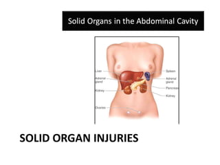 SOLID ORGAN INJURIES
 
