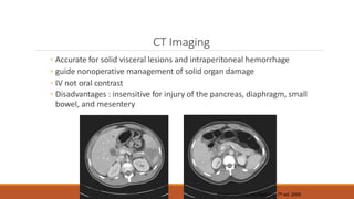 CT Imaging
◦ Accurate for solid visceral lesions and intraperitoneal hemorrhage
◦ guide nonoperative management of solid organ damage
◦ IV not oral contrast
◦ Disadvantages : insensitive for injury of the pancreas, diaphragm, small
bowel, and mesentery
Rosen’s Emergency Medicine, 7th ed. 2009
 
