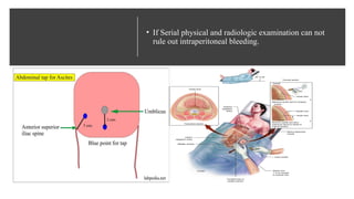abdominal trauma powerpoint explained for medical students | PPTX