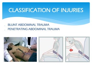 ABDOMINAL TRAUMA PRESENTATION, diagnosis | PPTX
