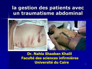 Abdominal trauma   french dr. nahla (1)