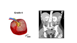 Comprehensive Overview of Pediatric and Adult Abdominal Trauma ...
