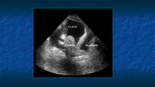Abdominal Trauma and FAST scan (Dr. Derhim Afaqeeh , Yemen ) | PPTX