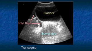 Fast Scan Report Abdominal Trauma and FAST scan (Dr. Derhim Afaqeeh , Yemen ) | PPTX
