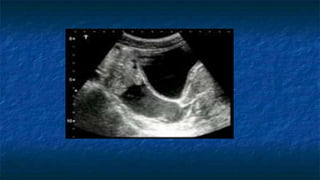 Abdominal Trauma and FAST scan (Dr. Derhim Afaqeeh , Yemen ) | PPTX