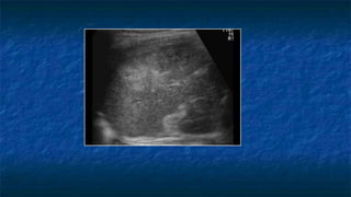 Abdominal Trauma and FAST scan (Dr. Derhim Afaqeeh , Yemen ) | PPTX