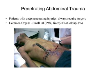 Penetrating Abdominal Trauma

• Patients with deep penetrating injuries always require surgery
• Common Organs –Small int.(29%) liver(28%) Colon(23%)
 
