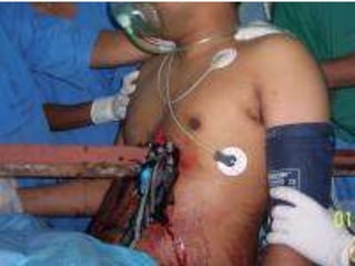 EAST Algorithm: Stable




      Eastern Association for the Surgery of Trauma, 2001
 