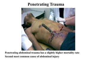 Penetrating Trauma




Penetrating abdominal trauma has a slightly higher mortality rate
Second most common cause of abdominal injury
 