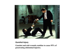 Gunshot Injury
Gunshot and stab wounds combine to cause 95% of
penetrating abdominal injuries.
 
