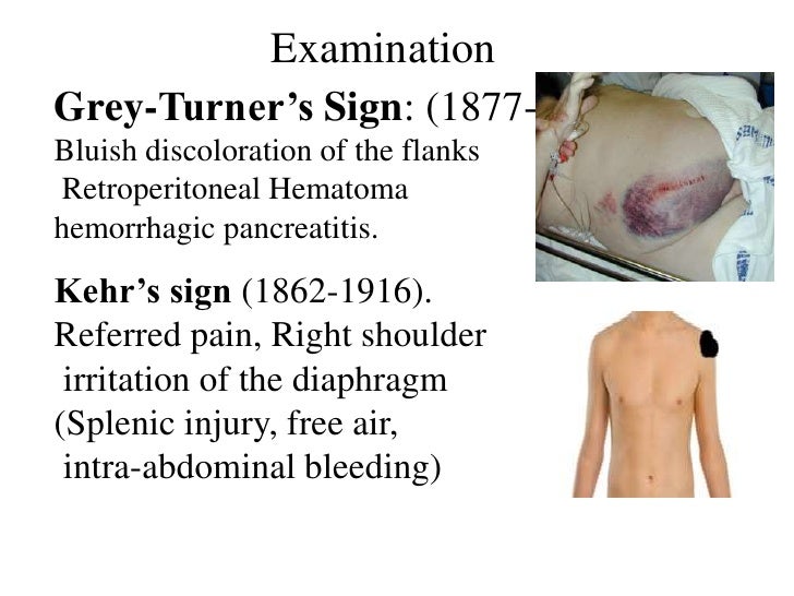 Abdominal trauma an overview