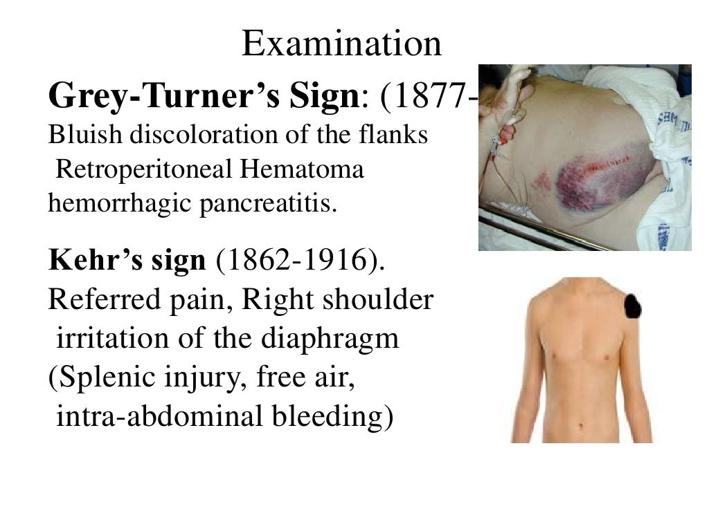 abdominal trauma abdominal trauma