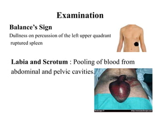 Abdominal trauma ,an overview | PPTX