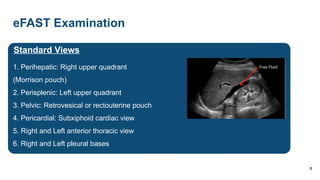 E Fast View A presentation on Abdominal Trauma and management.pptx