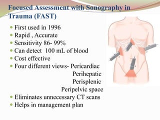 Abdominal trauma management | PPTX