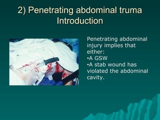 2) Penetrating abdominal truma2) Penetrating abdominal truma
IntroductionIntroduction
Penetrating abdominal
injury implies that
either:
•A GSW
•A stab wound has
violated the abdominal
cavity.
 