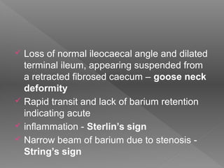  Loss of normal ileocaecal angle and dilated
terminal ileum, appearing suspended from
a retracted fibrosed caecum – goose neck
deformity
 Rapid transit and lack of barium retention
indicating acute
 inflammation - Sterlin’s sign
 Narrow beam of barium due to stenosis -
String’s sign
 