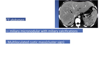 CT abdomen
— miliary micronodular with miliary calcifications
- Multiloculated cystic mass(cluster sign)
 