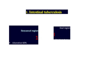 1.Intestinal tuberculosis
Ileocaecal region
1
• Ulcerative 60%
• Hypertrophic 10%
• Ulcerohypertrophic 30%
Ileal region
I
• Stricture type
 