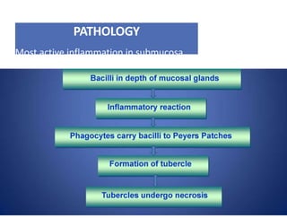 PATHOLOGY
Most active inflammation in submucosa.
 
